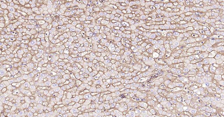 钠钾ATP酶蛋白a1即用型免疫组化试剂盒-IHC0259